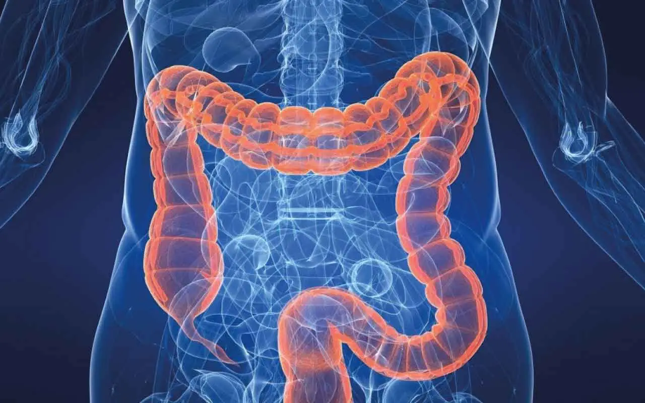 Il cibo fermentato che fa bene all’intestino Il cibo fermentato che fa bene all’intestino