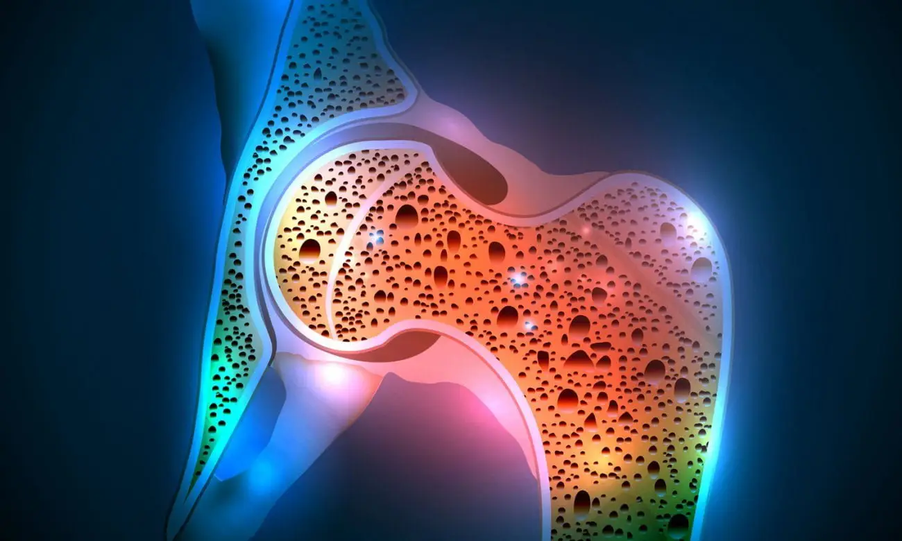 Prevenire l’osteoporosi: quali alimenti scegliere secondo la nutrizionista SS - Alimenti ricchi di calcio e ossa